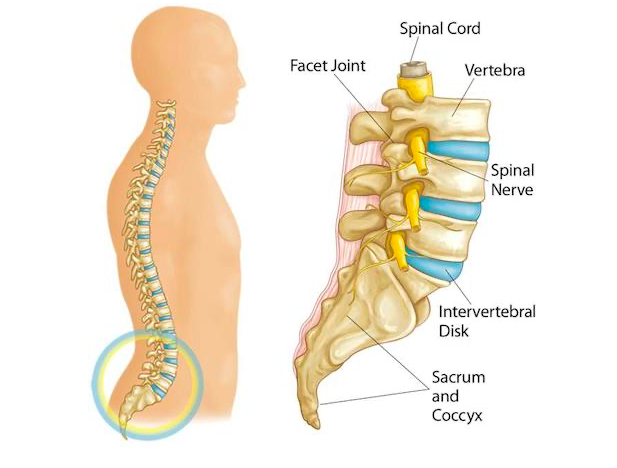 How to Solve Sciatica and Back Pain in 3 Steps
