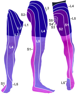 Dermatomes are a map which assists in diagnosing the source of sciatic pain.